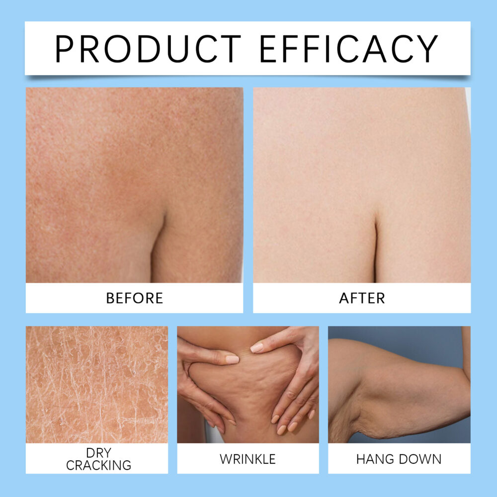 Hydrating Moisturizer Hydrating Moisturizing cream to improve skin elasticity Hydrating Shine Refreshing skin cream #JL04-OU-A06-0227-01 - Image 11
