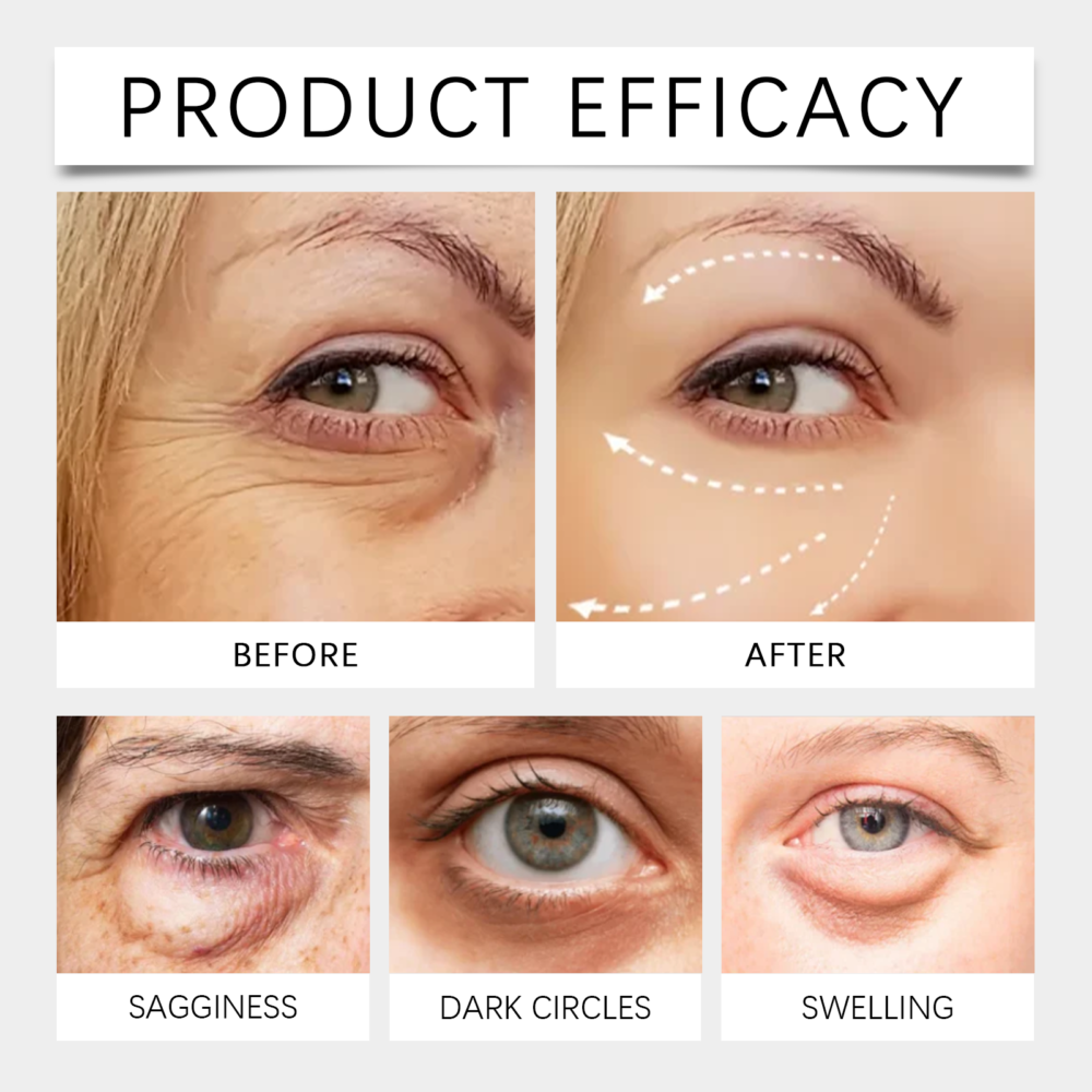 Nourishing Eye Cream Eye Essence Moisturizes the Lines around the eyes Gentle Brightening Skin Moisturizing Eye cream #JL04-HO-A05-0348-01 - Image 4