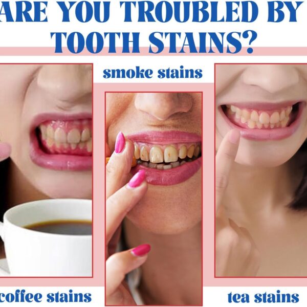 Nicotinamide toothpaste #JL02-A313-NT001 - Image 6