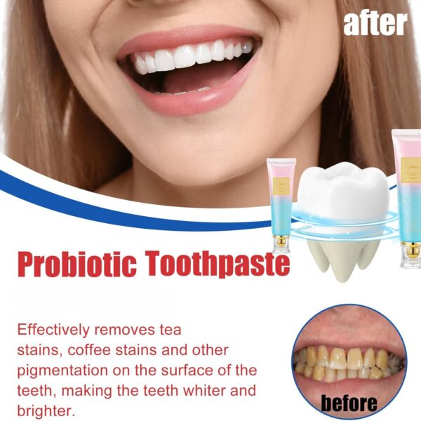 Nicotinamide toothpaste #JL02-A313-NT001 - Image 5