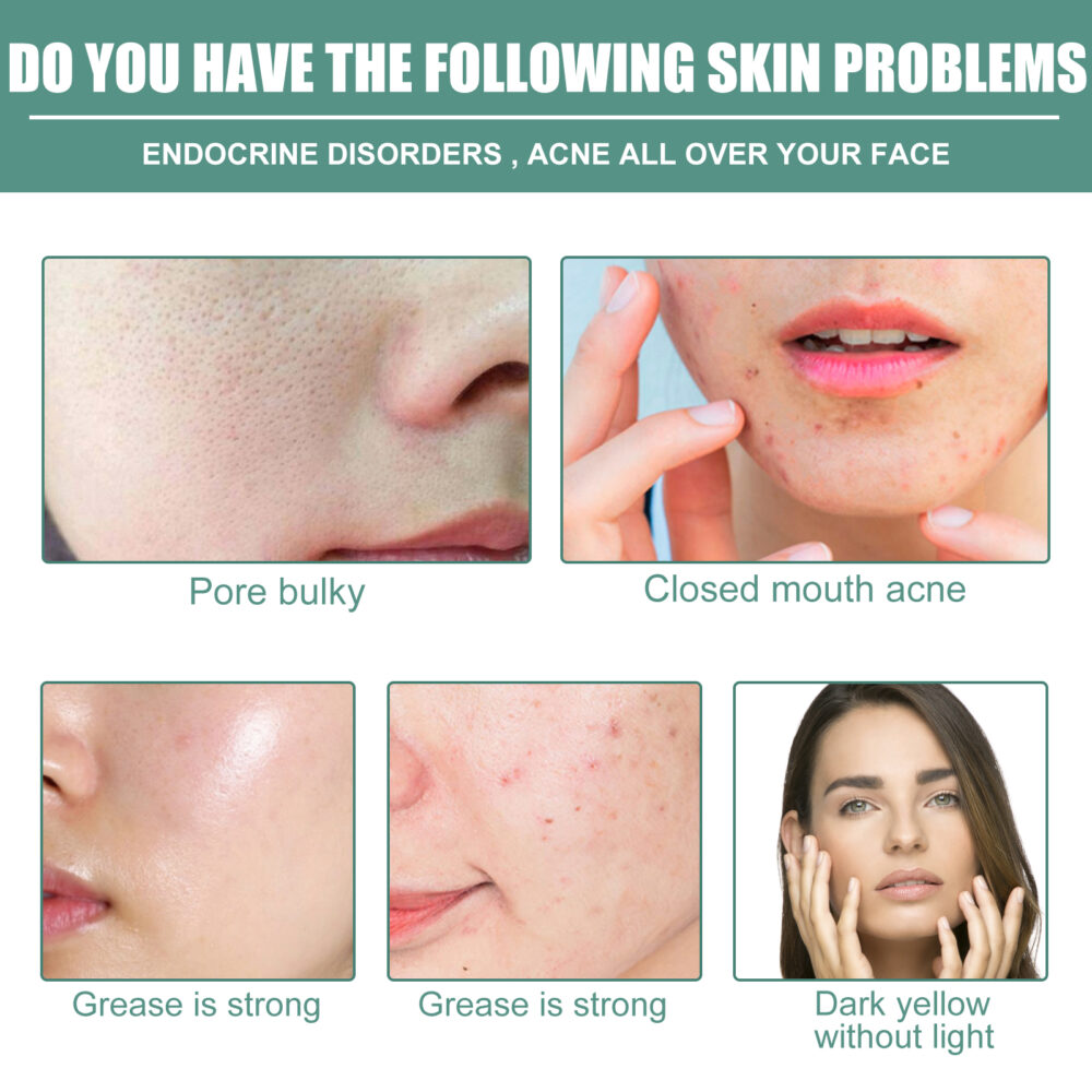 Retinol Facial Elastic, Anti-aging, pore-narrowing, brightening and firming Essence #JL04-sHc929yx01-30ml - Image 3