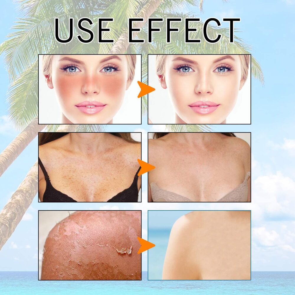 Hyaluronic Acid Hydra Sunscreen 50ml Chemical Sunscreen Hydra Breathable strong sunscreen #JL02-A313-Blue Sun Gel - Image 9
