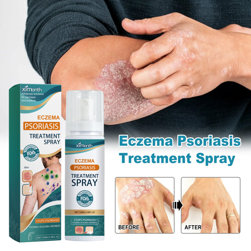 Skin Moss Repair Spray Repair Hands and Feet Skin Moss to relieve redness, itching and itchy skin care #JL04-XIA06-A247-100-GN1 - Image 4