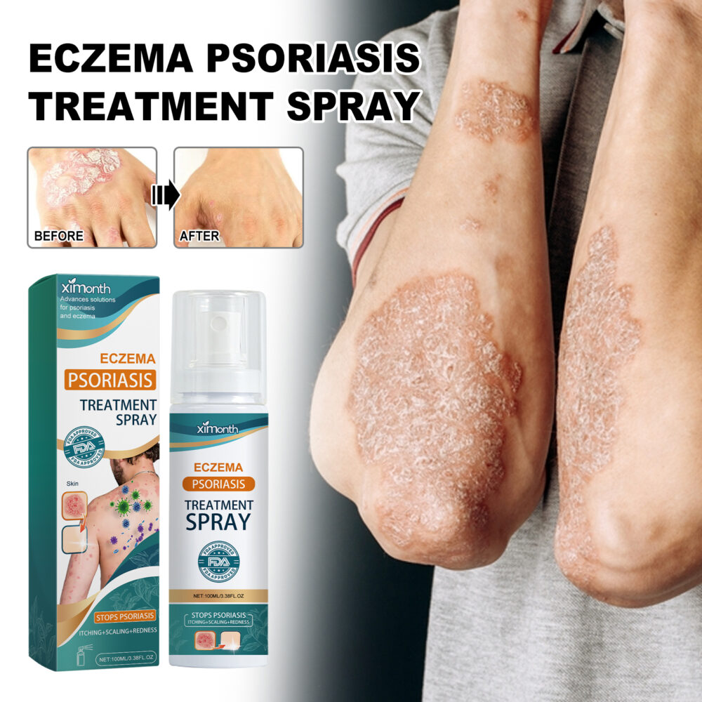 Skin Moss Repair Spray Repair Hands and Feet Skin Moss to relieve redness, itching and itchy skin care #JL04-XIA06-A247-100-GN1