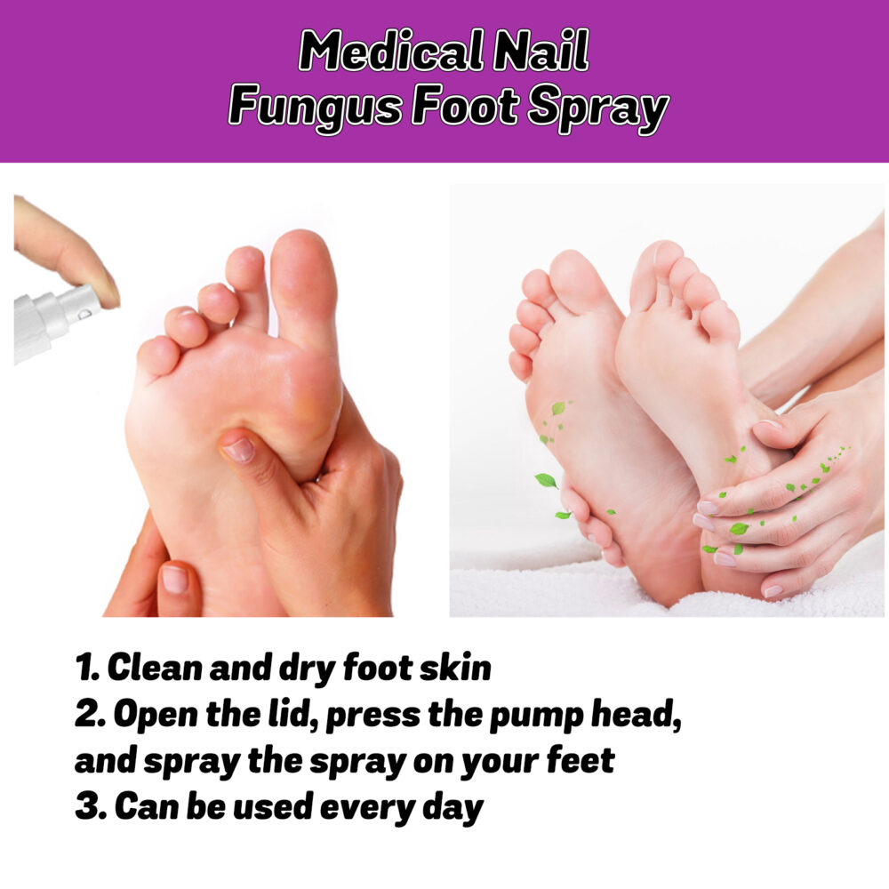 Foot Care Spray Relieves foot odor and sweat Foot Cleaning Desalinates odor and relieves itch Refreshing foot spray #JL04-XIA07-A011-35-VT1 - Image 8