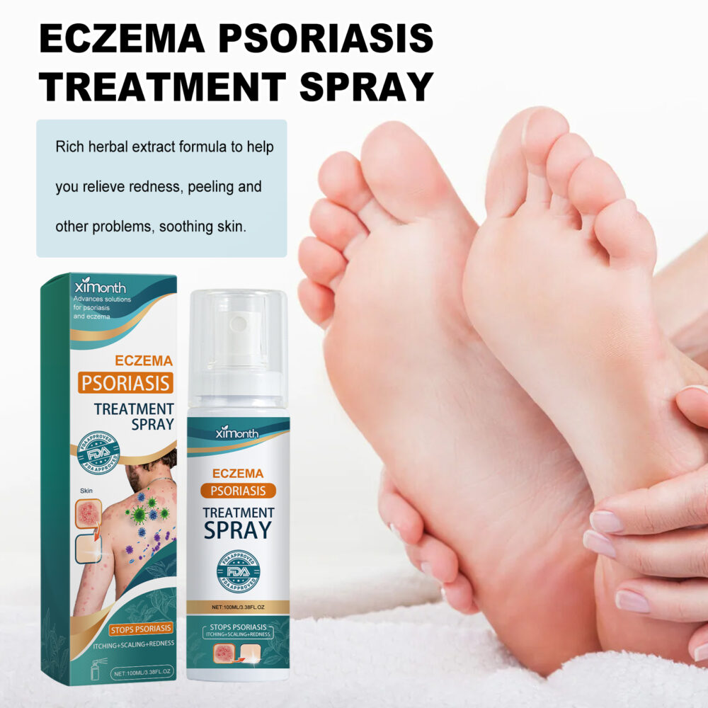 Skin Moss Repair Spray Repair Hands and Feet Skin Moss to relieve redness, itching and itchy skin care #JL04-XIA06-A247-100-GN1 - Image 8