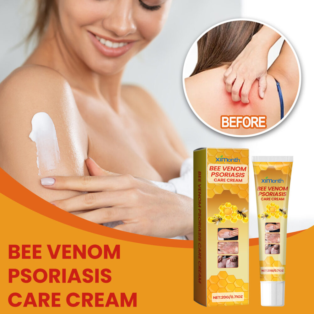 Bee-poison cowhide Moss Cream Relieves redness, itchiness and swelling skin Repair ointment #JL04-XIB05-A024-20-YE1 - Image 9