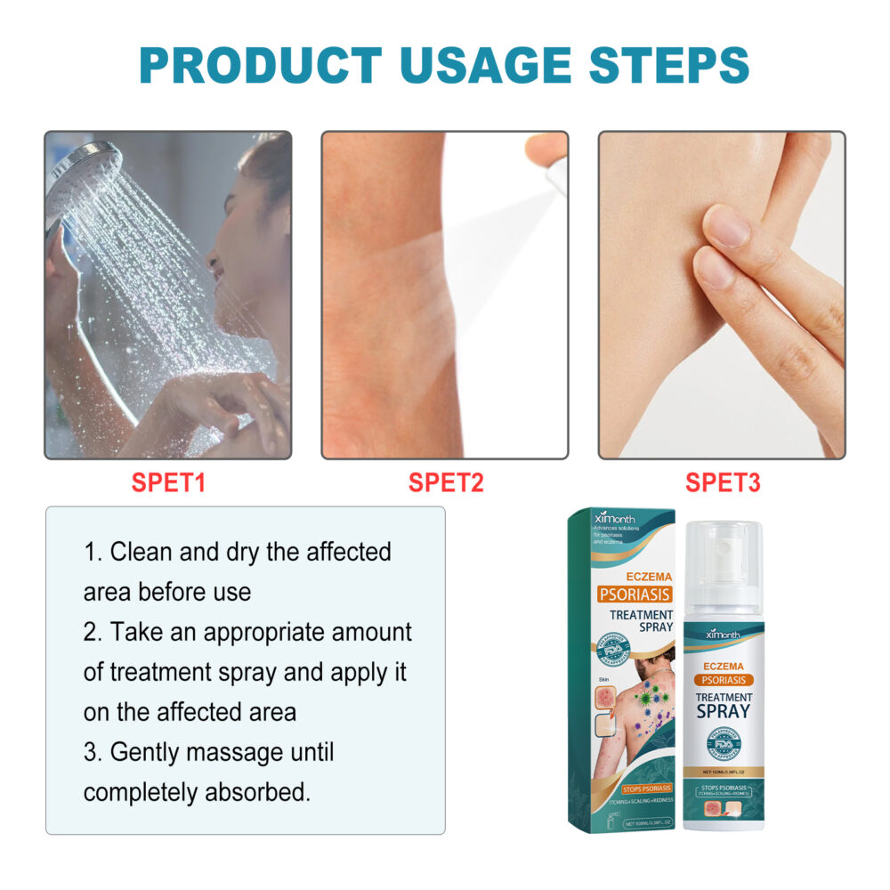 Skin Moss Repair Spray Repair Hands and Feet Skin Moss to relieve redness, itching and itchy skin care #JL04-XIA06-A247-100-GN1 - Image 10