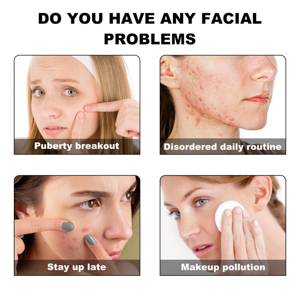 Green Acne Patch Pimples Acne Care Pimples Print Facial Care Irregular shape acne patch #JL04-JAA05-A006-140-GN1 - Image 3