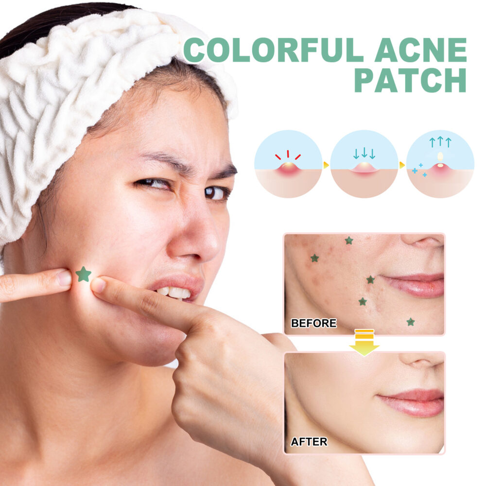 Green Acne Patch Pimples Acne Care Pimples Print Facial Care Irregular shape acne patch #JL04-JAA05-A006-140-GN1 - Image 5