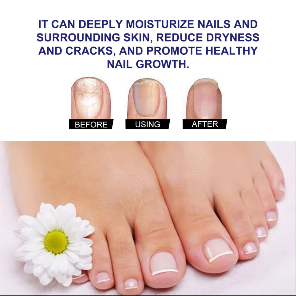 Nail Care Solution Repair Hand, Foot, Soft Nails, Thickening, Brightening Nails, Moisturizing and Cleaning Nail Care solution #JL04-SOA07-A007-10-BU1 - Image 5