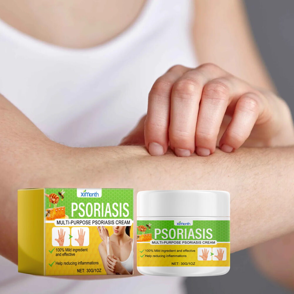 Skin care cream relieves itching, redness, pain and moisturizes skin #JL04-XIB04-A040-30-YE1