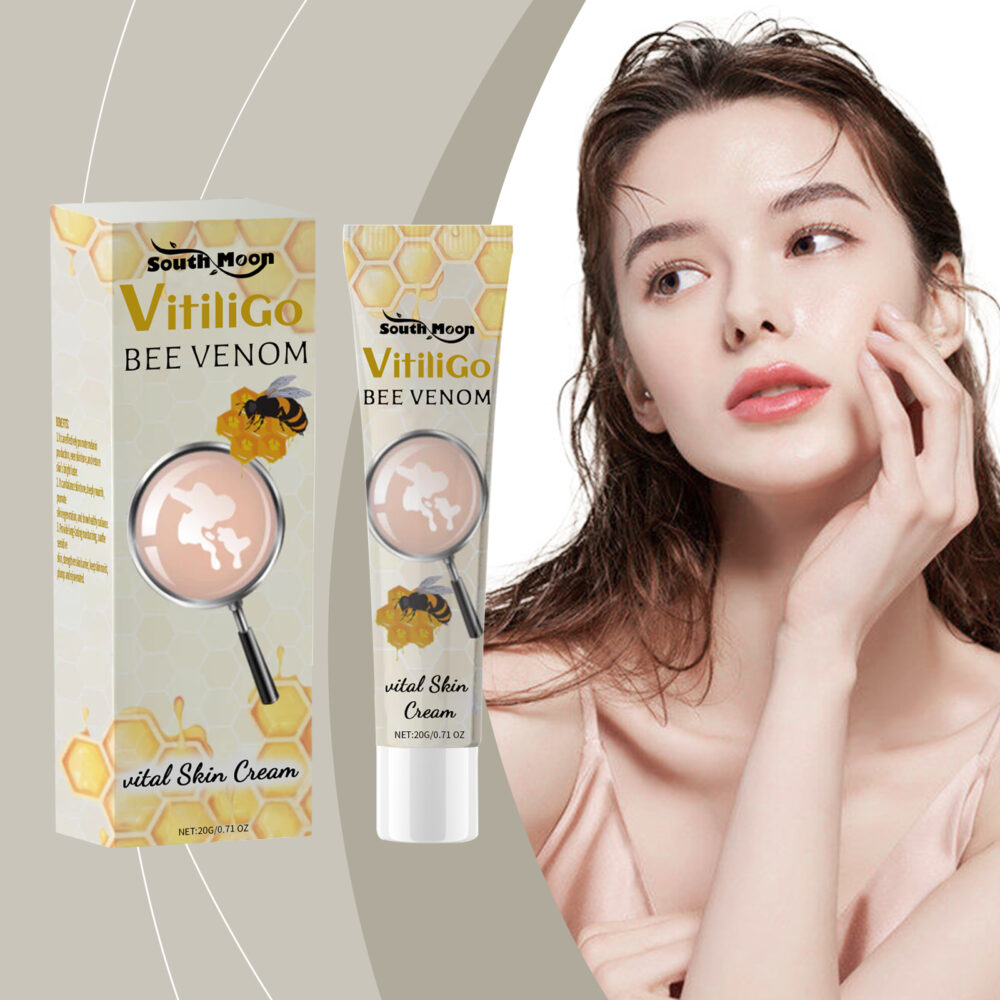 White Spot Care Cream Lighten white spot Body Skin Care Even skin topical care cream #JL04-SOB06-A006-20-YE1
