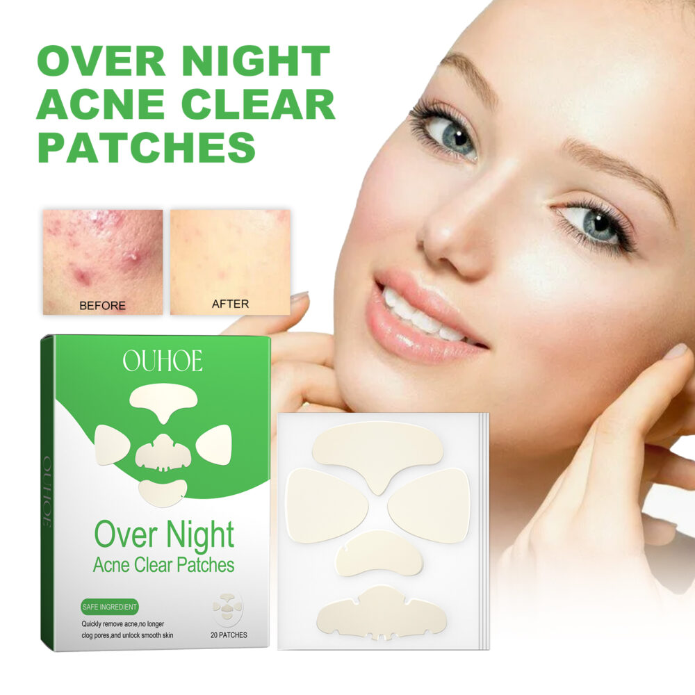 Facial Acne Patch gently repair facial acne pimples closed mouth fade acne pits acne marks smooth skin #JL04-OUA05-A022-20-WH1 - Image 3