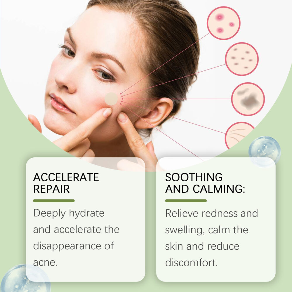 Acne Patch Gentle Cleansing helps relieve facial blemishes Appearance Concealer Breathable Facial Patch #JL04-OUA05-A161-36-WH1 - Image 3