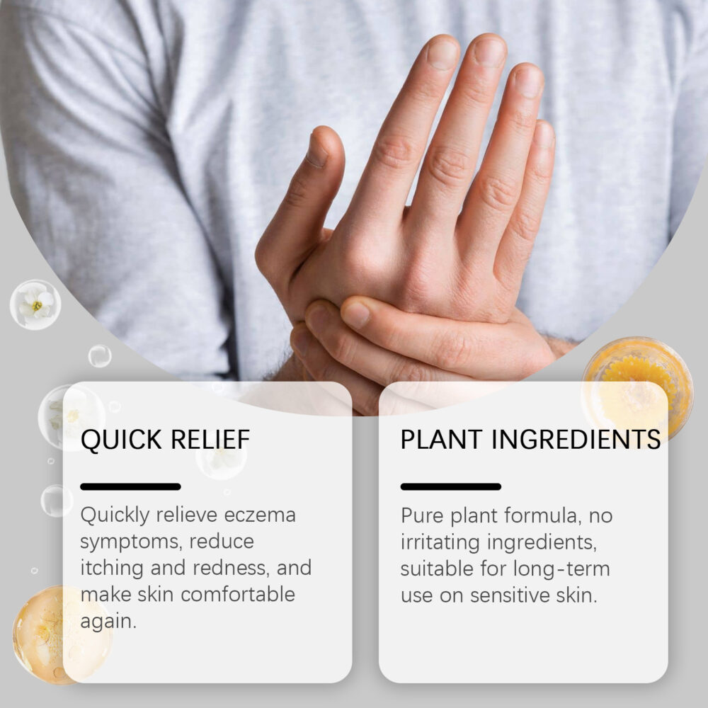 Skin Care Herbal Cream Moisturizing cream to relieve dry, itchy, red skin on hands and feet #JL04-XIB06-A015-57-WH1 - Image 2