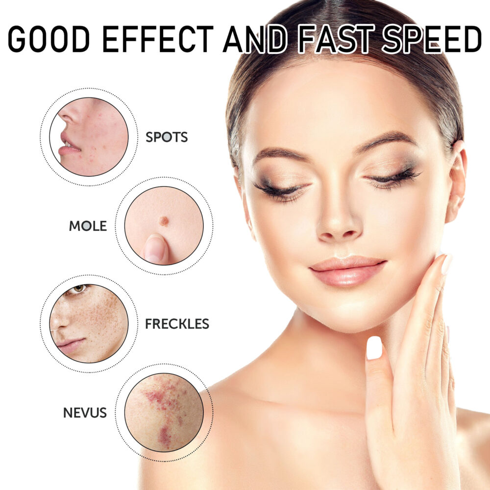 Anti-wart Serum Cleanses Skin Fleshy Nevus Repair Smoothing Body Skin Anti-Wart care #JL04-XIA05-A004-30-BU1 - Image 4