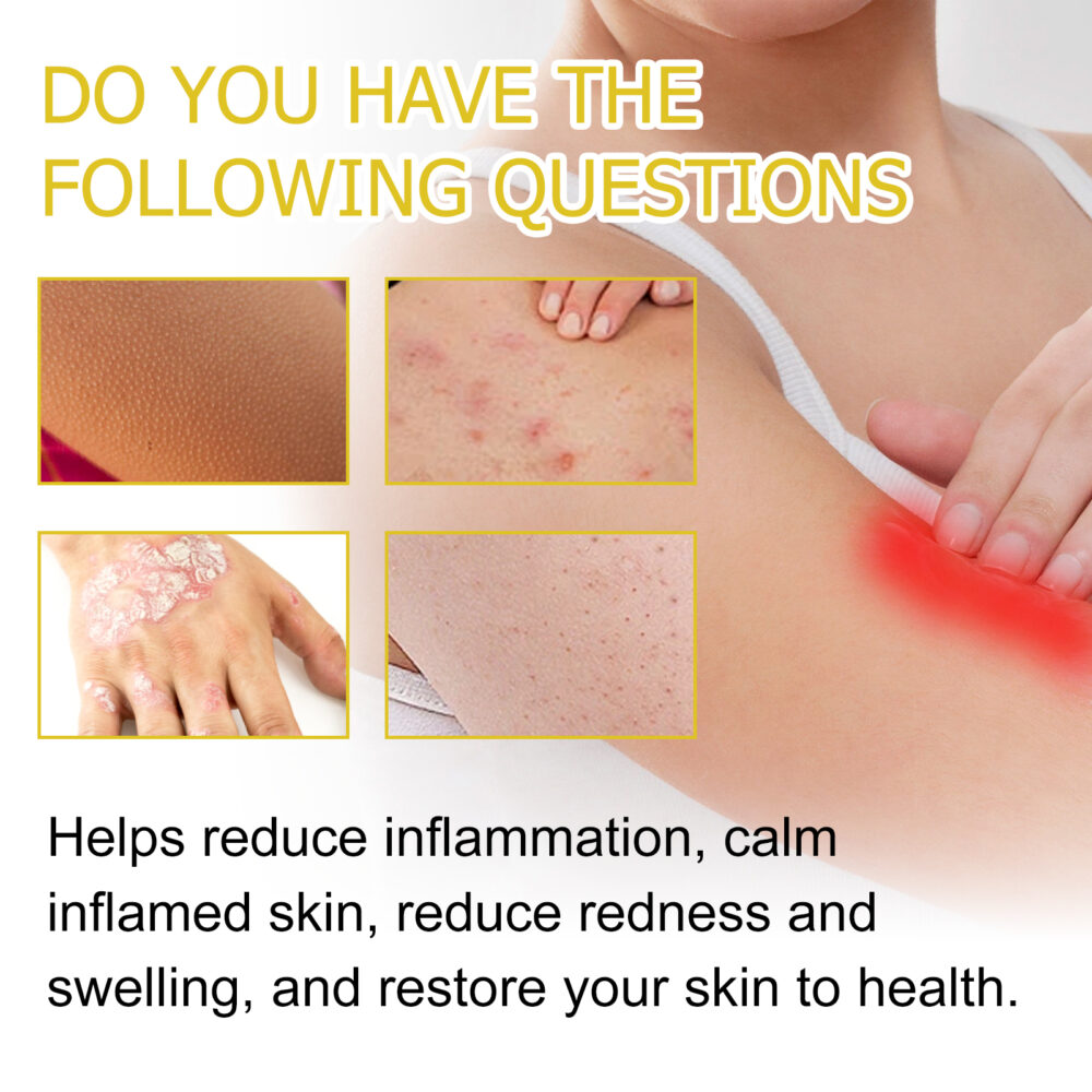 Skin care cream relieves itching, redness, pain and moisturizes skin #JL04-XIB04-A040-30-YE1 - Image 4