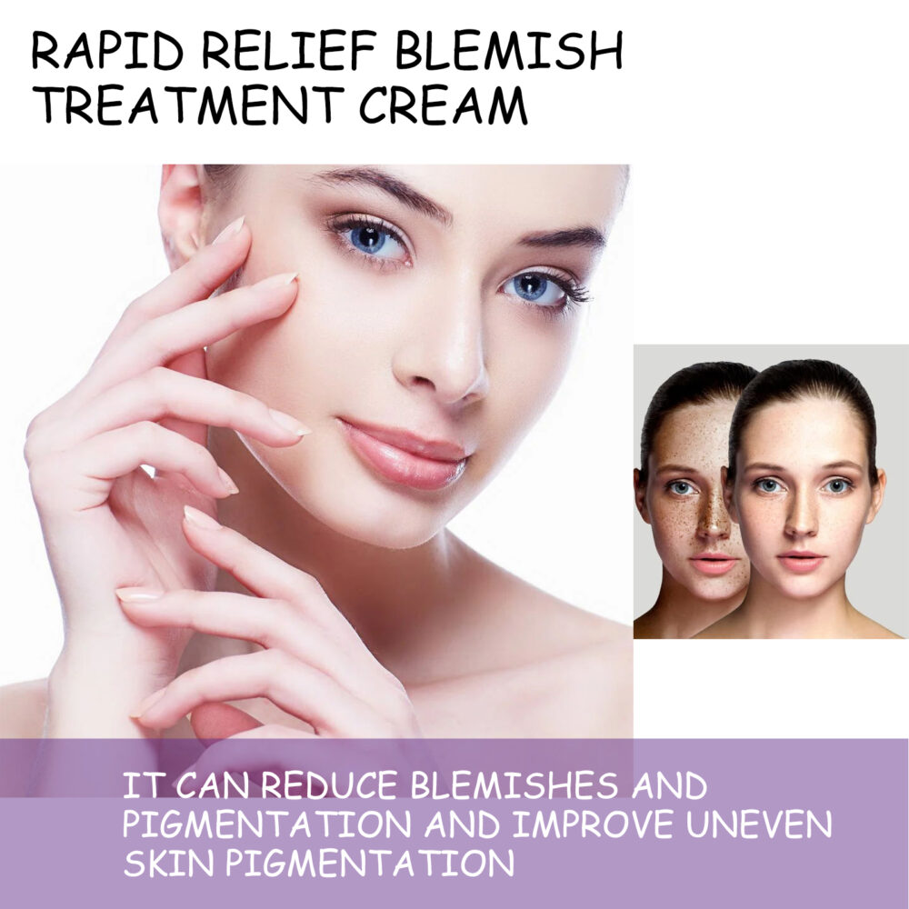 Remove Shift Whitening Care Cream Repair Dark spots Dull Moisturizing and brightening Beauty Cream #JL04-OUA05-A044-20-WH1 - Image 4