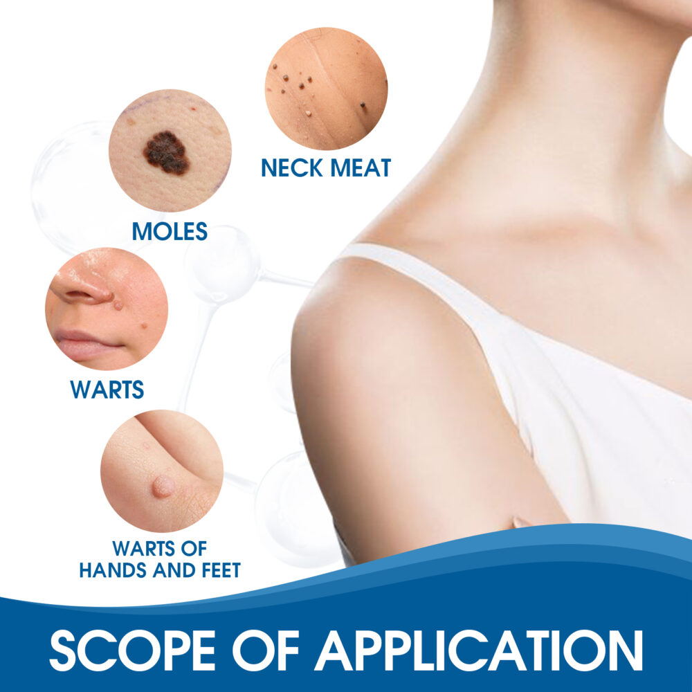 Kero Patch Lighten Dark nevus Kero Repair Meat Grain Callus Corns Skin Cleaning and smoothing patch #JL04-XIB04-A002-144-BU1 - Image 4