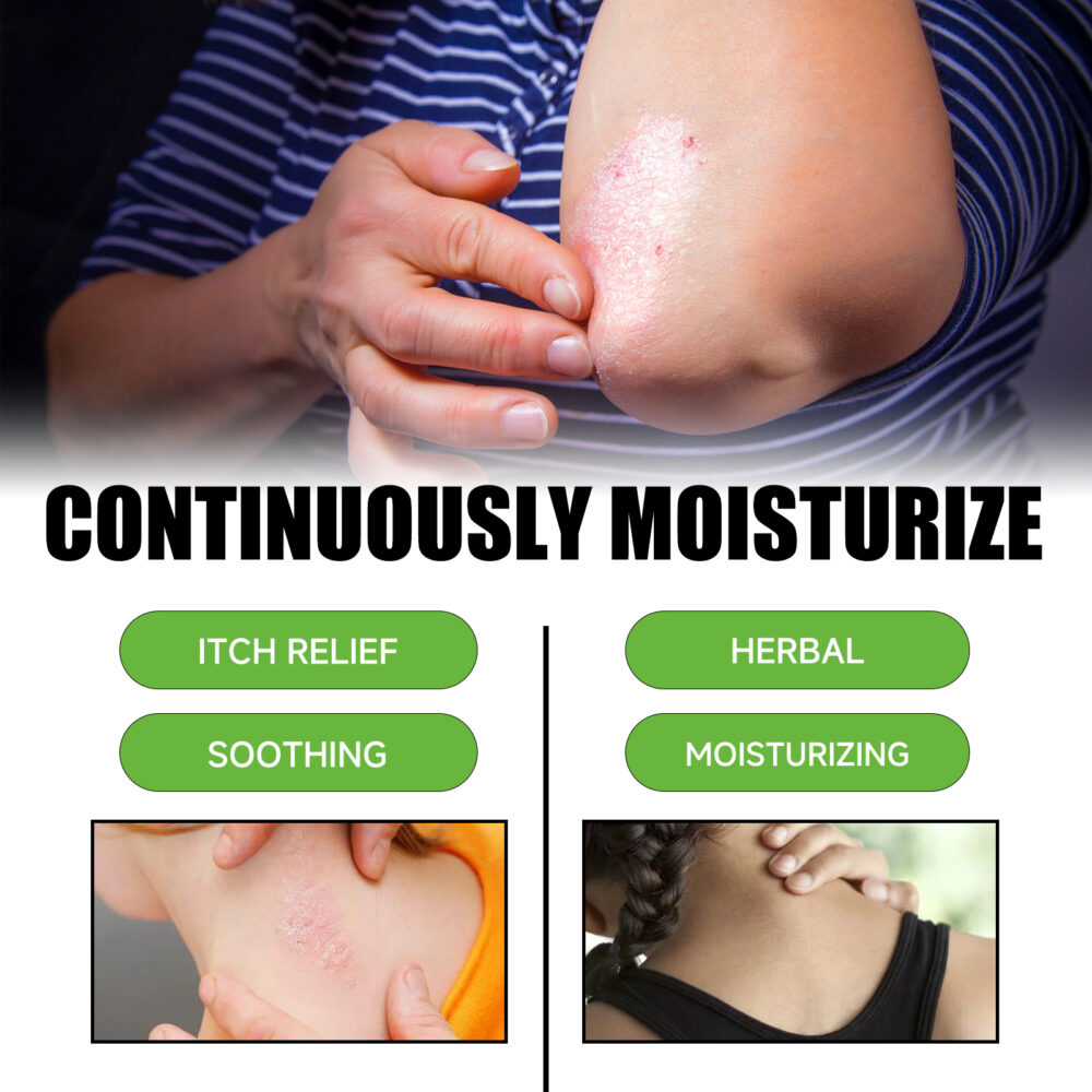 Skin care cream relieves itching, redness, pain and moisturizes skin #JL04-XIB04-A040-30-YE1 - Image 5