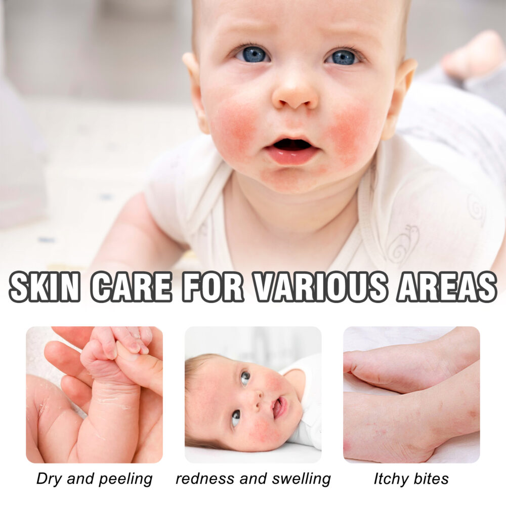 Skin Repair Cream to relieve skin redness, relieve itching, Repair and moisturize skin Care cream #JL04-WIA06-A001-50-WH1 - Image 5