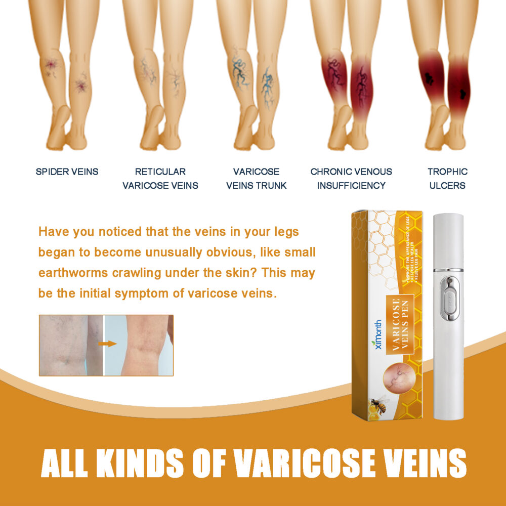 Leg Repair pen relieves discomfort from leg bumps and leg Massage Treatment Body repair pen #JL04-XIA08-A005-1-YE1 - Image 5