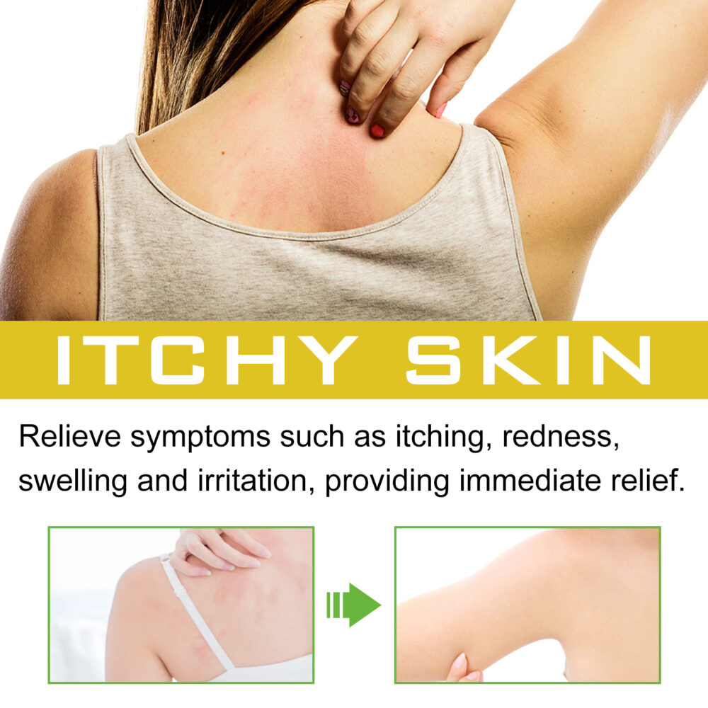 Skin Repair Spray to relieve skin discomfort Repair Moisturizing and tender skin care spray #JL04-SOA06-A028-30-YE1 - Image 6