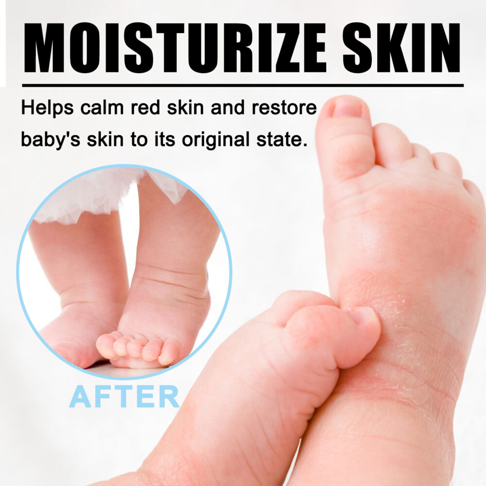 Skin Repair Cream to relieve skin redness, relieve itching, Repair and moisturize skin Care cream #JL04-WIA06-A001-50-WH1 - Image 6
