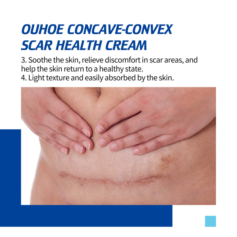 Scar Repair Cream Gentle Repair Smooth skin Fade scar Skin repair cream after surgery #JL04-OUA06-A141-30-WH1 - Image 6