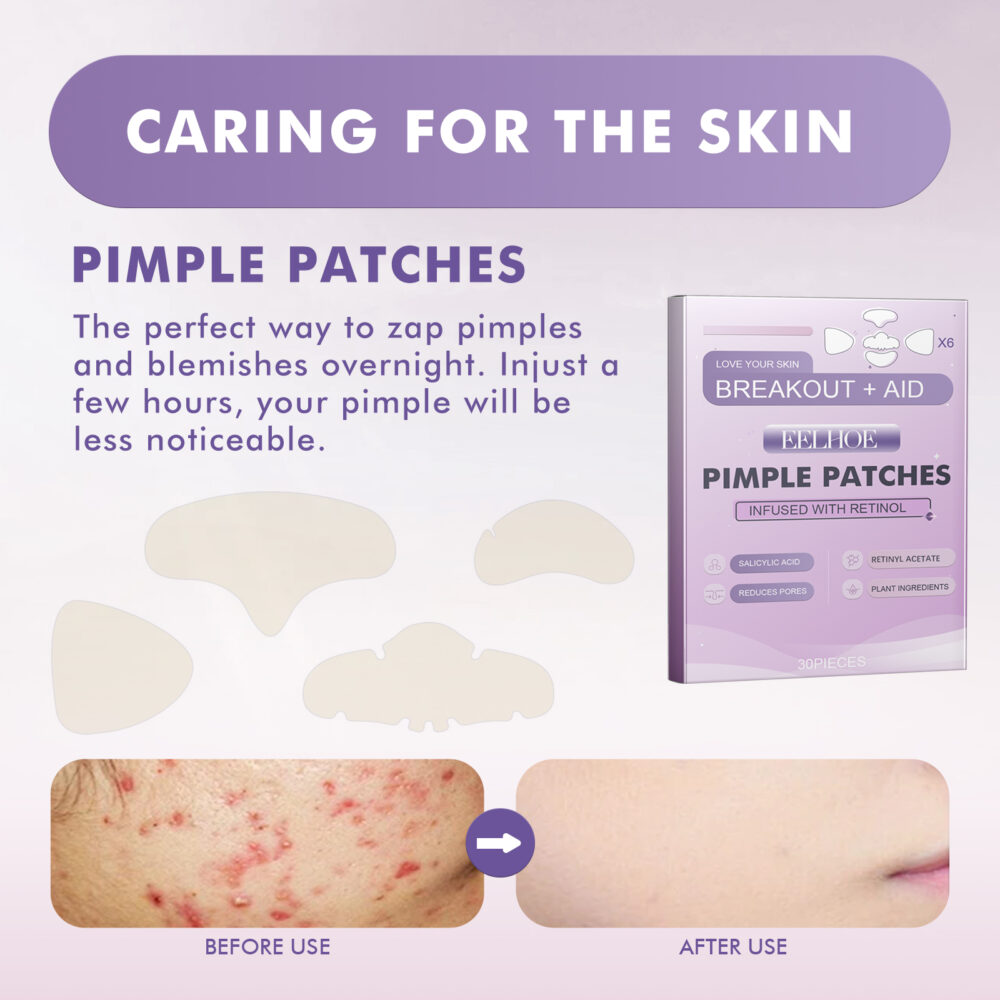 Cheek Acne Patch Salicylic Acid Facial Treatment for Acne Acne Closing Gentle Cleansing Patch #JL04-EEA05-A015-30-VT1 - Image 6