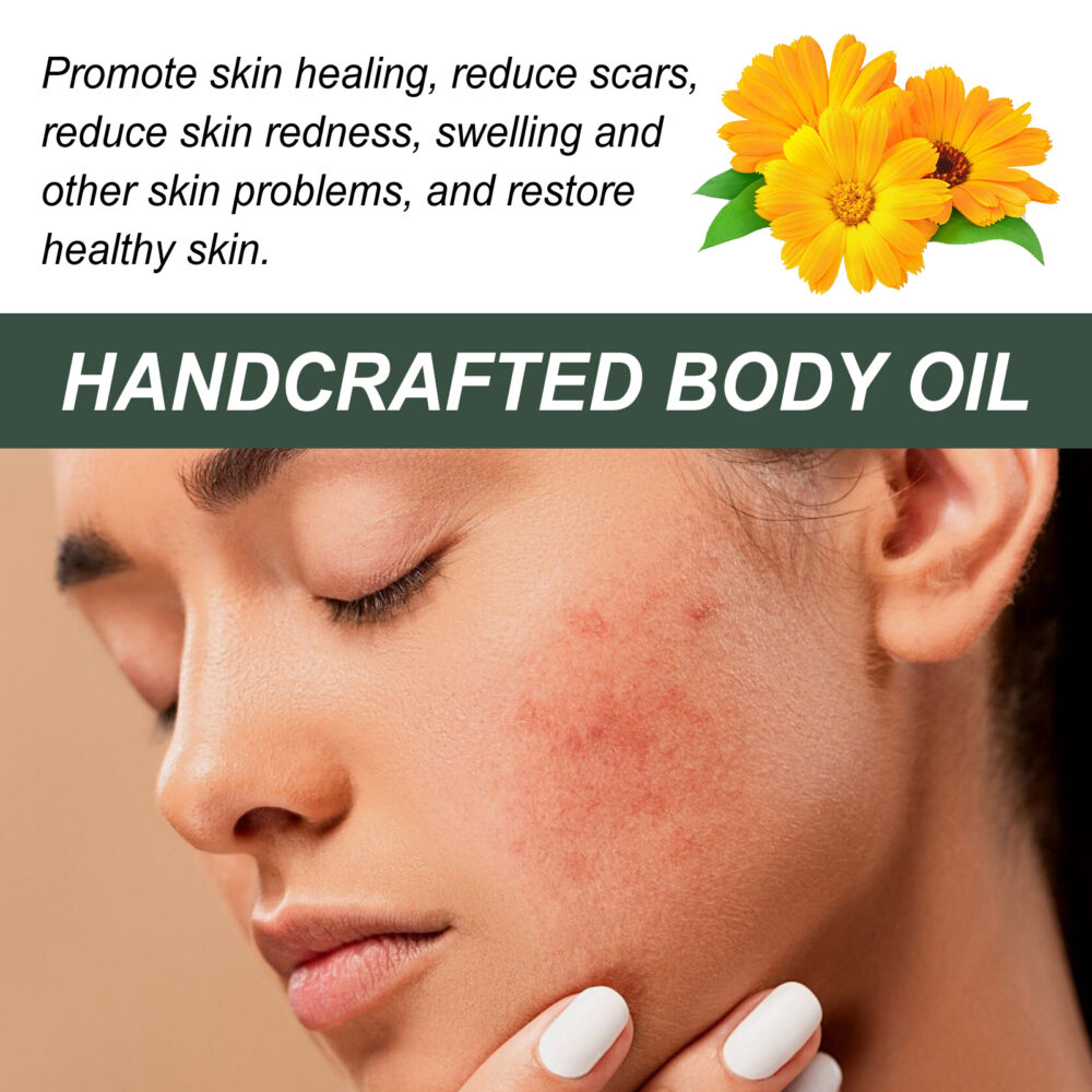 Calendula Care Essential oil reduces scar skin redness, moisturizes smooth and firming care #JL04-WOA06-A002-30-BN4 - Image 7