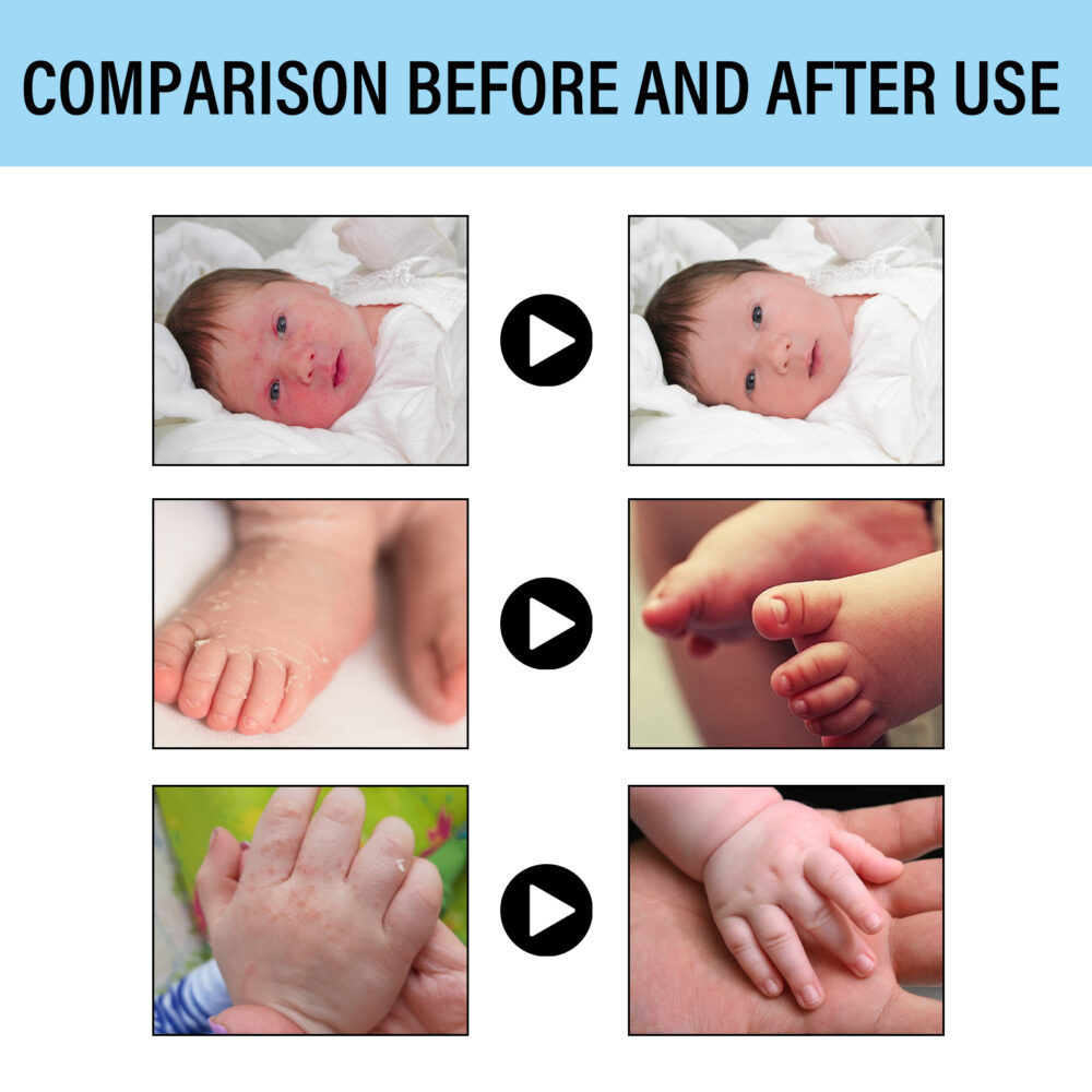Skin Repair Cream to relieve skin redness, relieve itching, Repair and moisturize skin Care cream #JL04-WIA06-A001-50-WH1 - Image 8