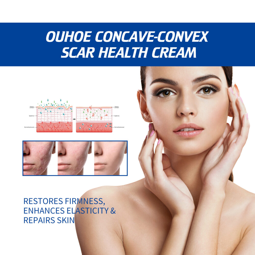 Scar Repair Cream Gentle Repair Smooth skin Fade scar Skin repair cream after surgery #JL04-OUA06-A141-30-WH1 - Image 10