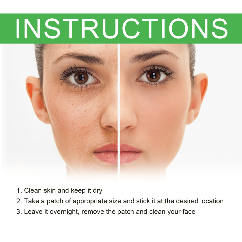 Facial Acne Patch gently repair facial acne pimples closed mouth fade acne pits acne marks smooth skin #JL04-OUA05-A022-20-WH1 - Image 10