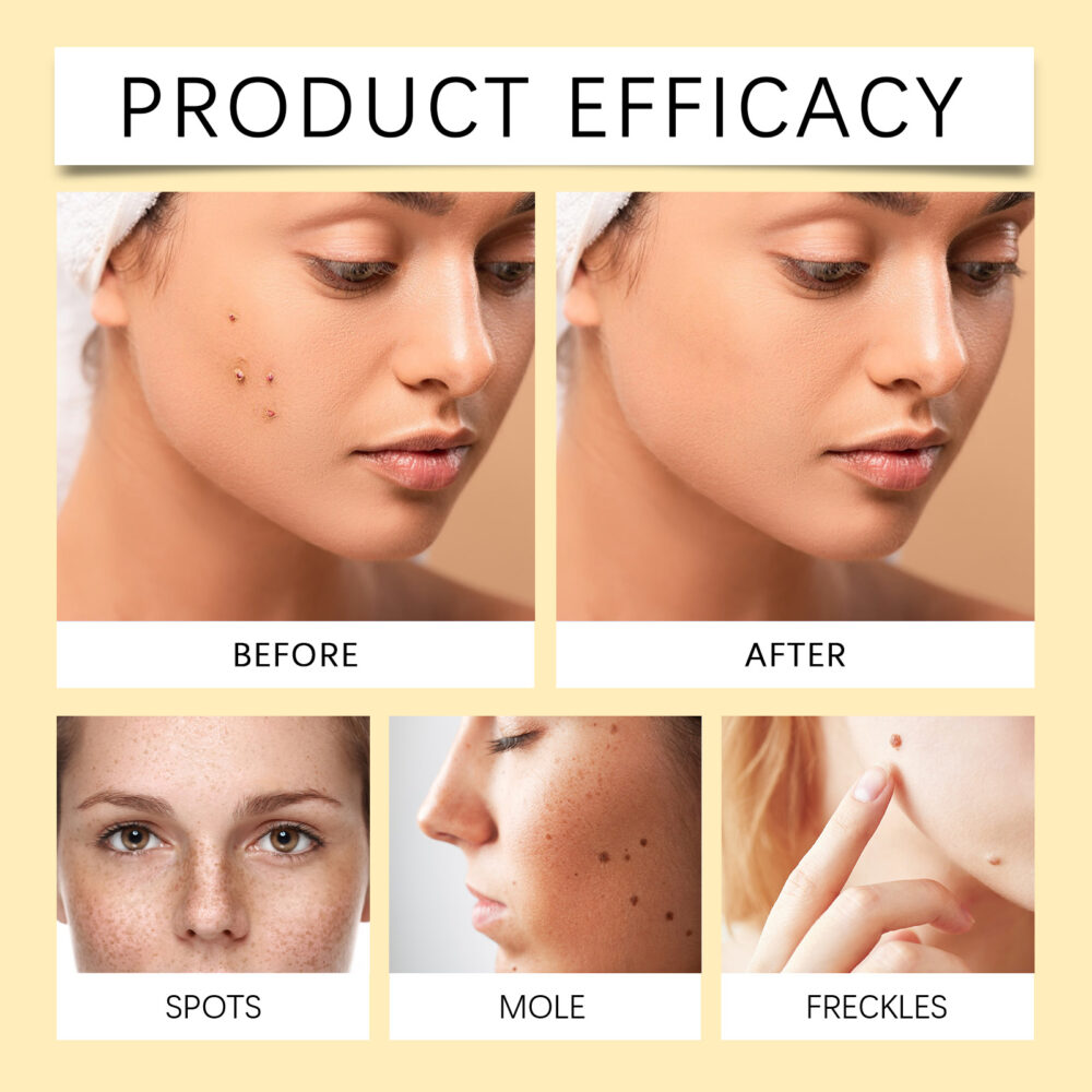 Kwart Granule Serum BrighTening and Moisturizing Moisturizing Refreshing and Cleansing Kyou Essence for skin #JL04-OUA05-A159-30-WH1 - Image 10