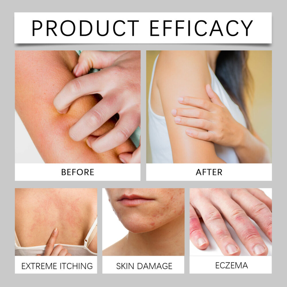 Skin Care Herbal Cream Moisturizing cream to relieve dry, itchy, red skin on hands and feet #JL04-XIB06-A015-57-WH1 - Image 9