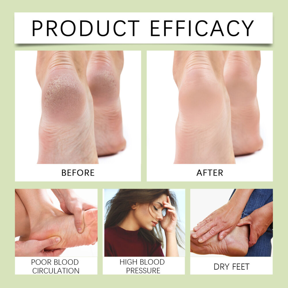 Ginger Foot Bath Pack Herbal Foot Bath Pack loosens muscle tension and cleans and maintains feet #JL04-SOB05-A008-10-WH1 - Image 10