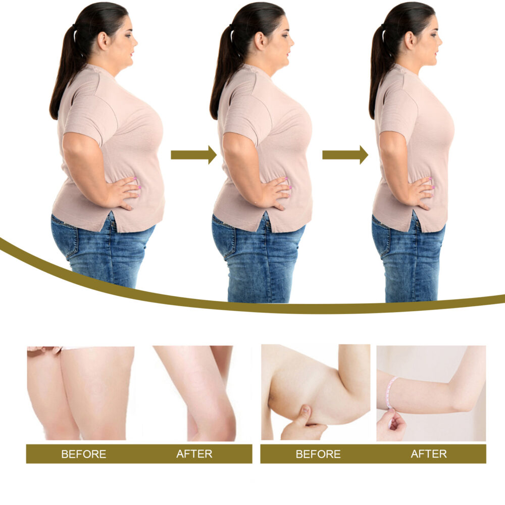 Beesvenom Slimming Nose Soothing Body Care to Show off the body Light Belly Slimming Body Shaping Cream #JL04-XIB03-A011-30-WH1 - Image 4