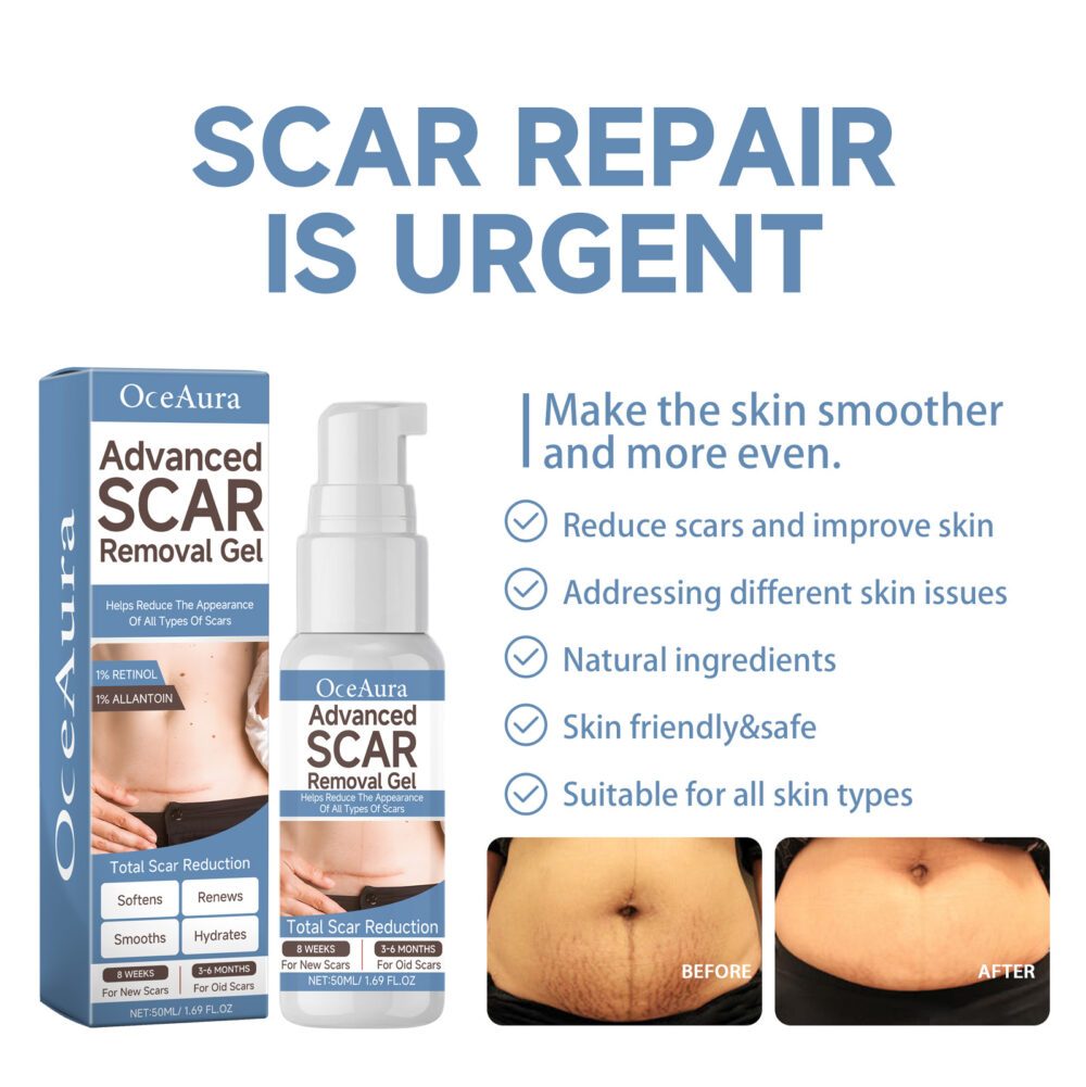 Scar Whitening Repair Gel Moisturizes smooth skin repair surgery scar pregnancy care gel #JL04-OCA06-A034-50-BU1 - Image 4
